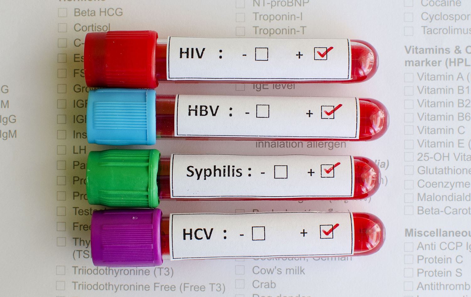 رێکخراوی تەندروستیی جیهانی: ژمارەی تووشبووانی نەخۆشییە سێکسییە گوازراوەکان زیادبووە