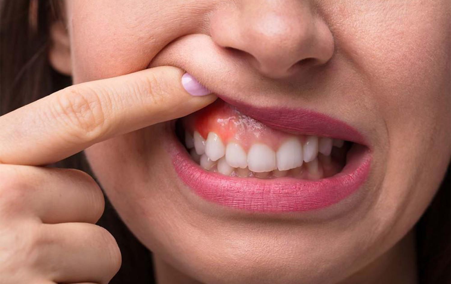 دەمشۆری ماتچا هەوکردنی پووک کەم دەکاتەوە