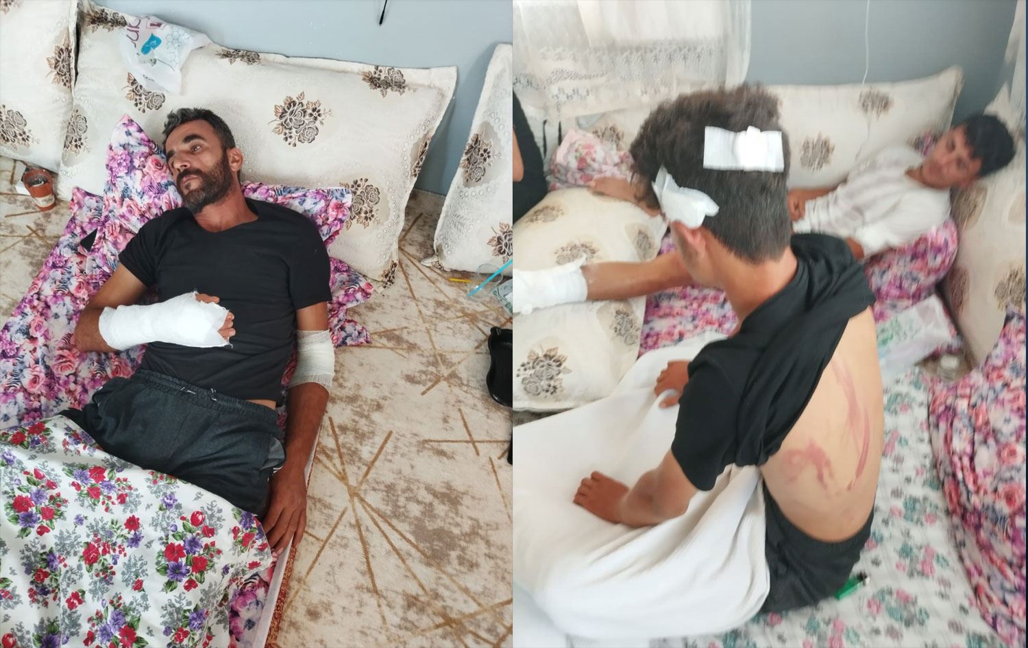 Foto: Saldırıya uğrayan işçiler