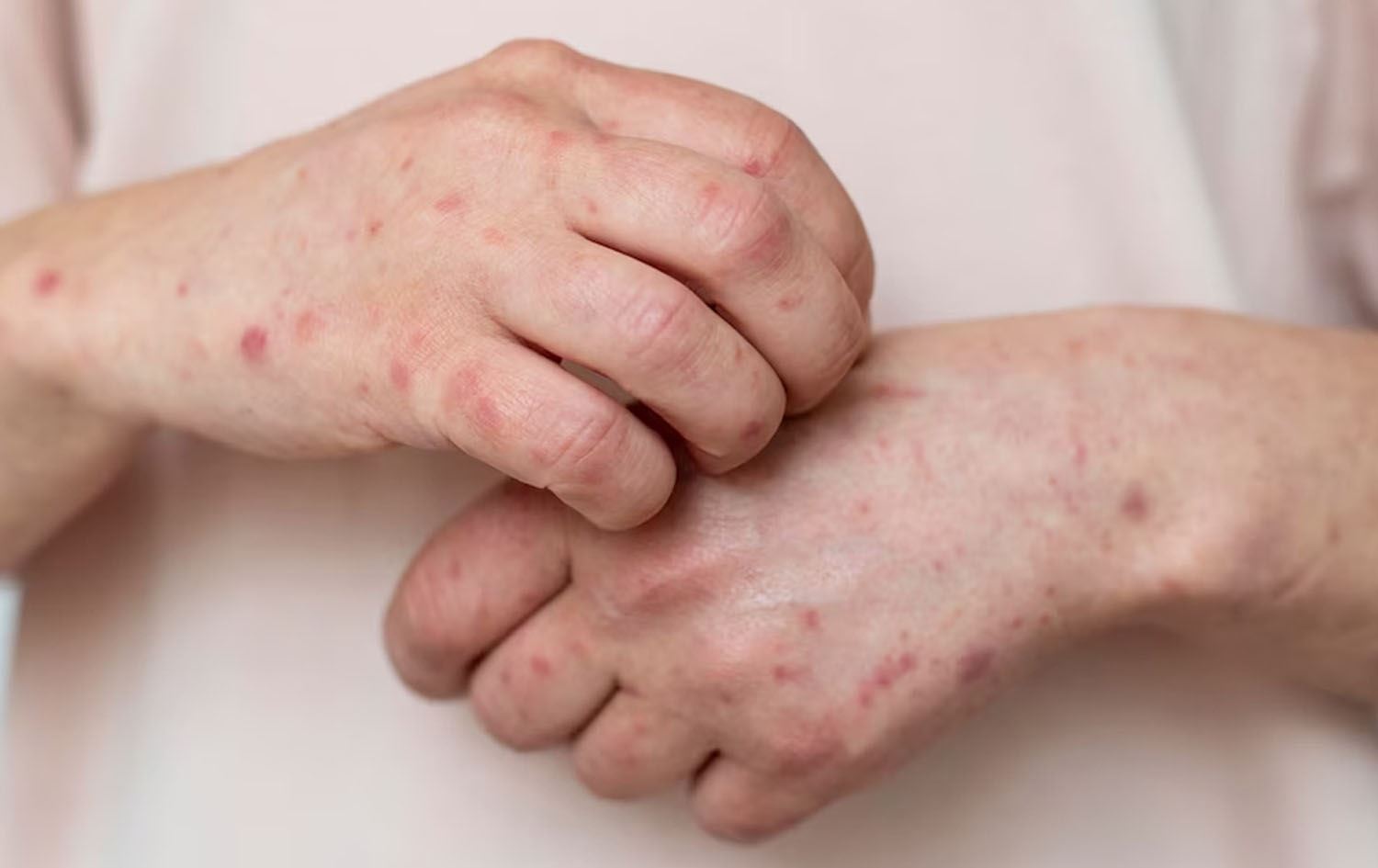 FDA: پشکنینێکی نەخۆشیی زوهری پەسندکرا کە دەشێت لەماڵەوە ئەنجامبدرێت