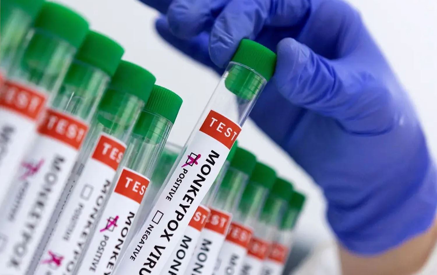 یەکەم تووشبووی نەخۆشیی 'ئاوڵەی مەیموون' لە فلیپین تۆمارکرا