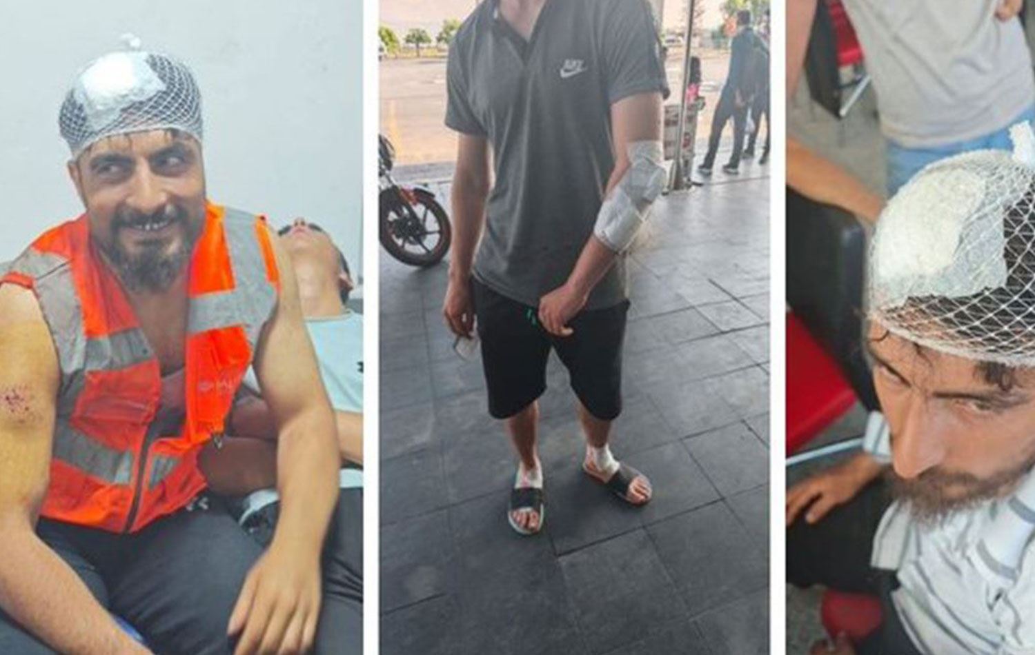 Saldırıya uğryan işçiler / Foto: MA