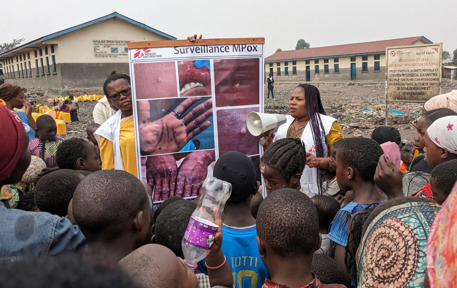 وێنە: بڵاوکردنەوەی هۆشیاری خۆپارێزی لە نەخۆشیی 'ئاوڵەی مەیموون' 