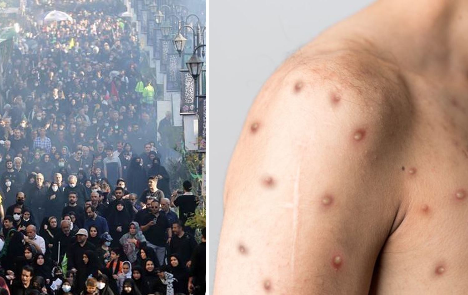 نیشانەیەکی ئاوڵەی مەیموون و بەڕێوەچوونی مەراسیمی چلەی ''ئیمام حوسێن''.