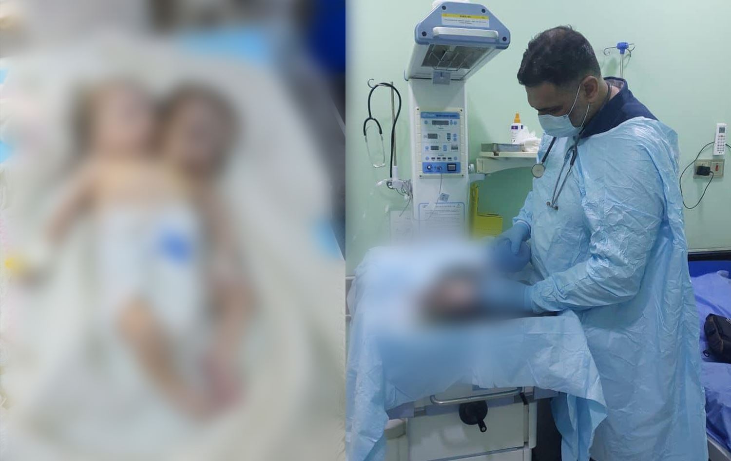 Wêneyê zarokê bi du seriyan / Wêne: Birêviberiya Tenduristiyê ya Enbarê