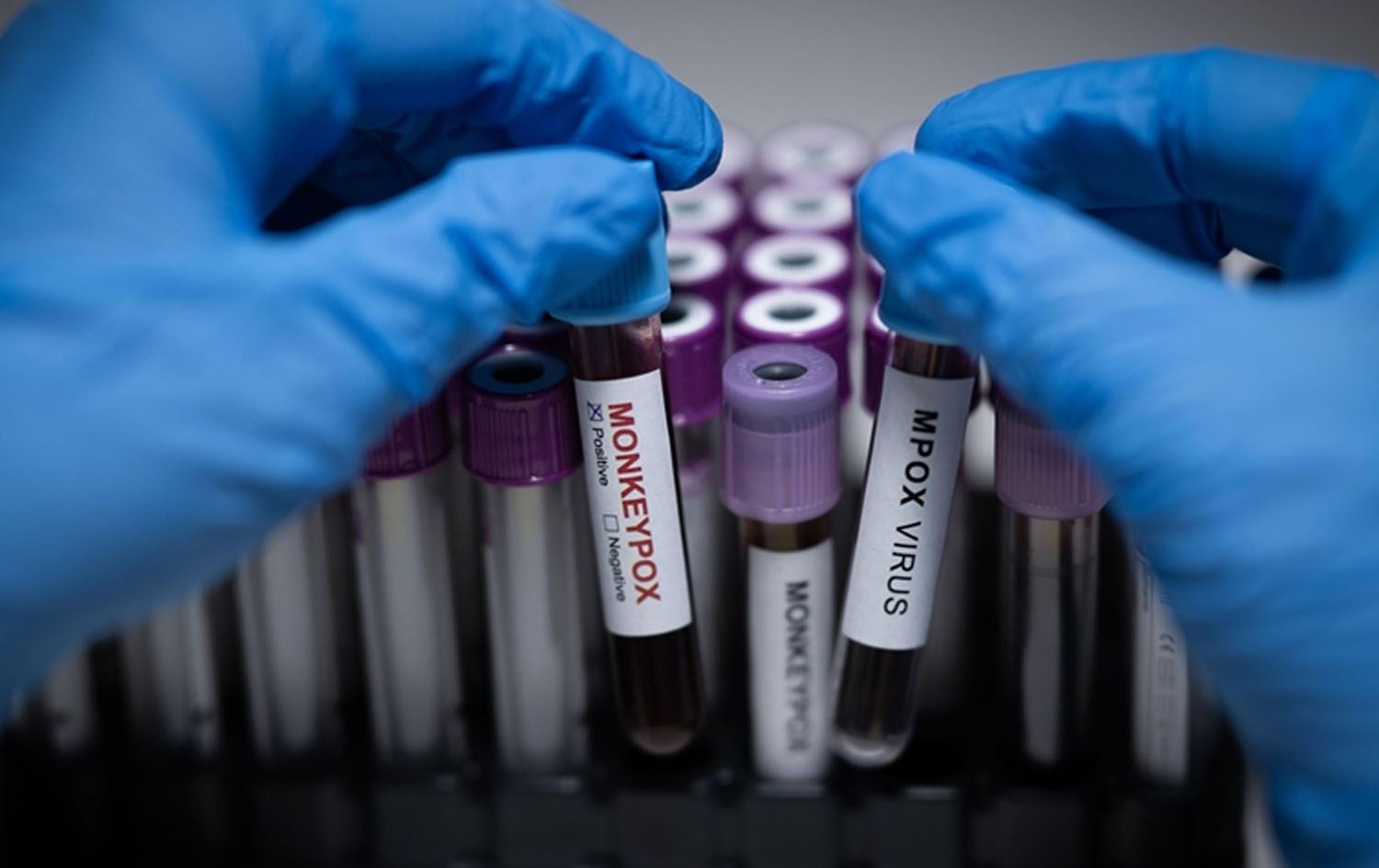 ژمارەی تووشبووانی نەخۆشیی 'ئاوڵەی مەیموون' لە پاکستان گەیشتە حەوت کەس