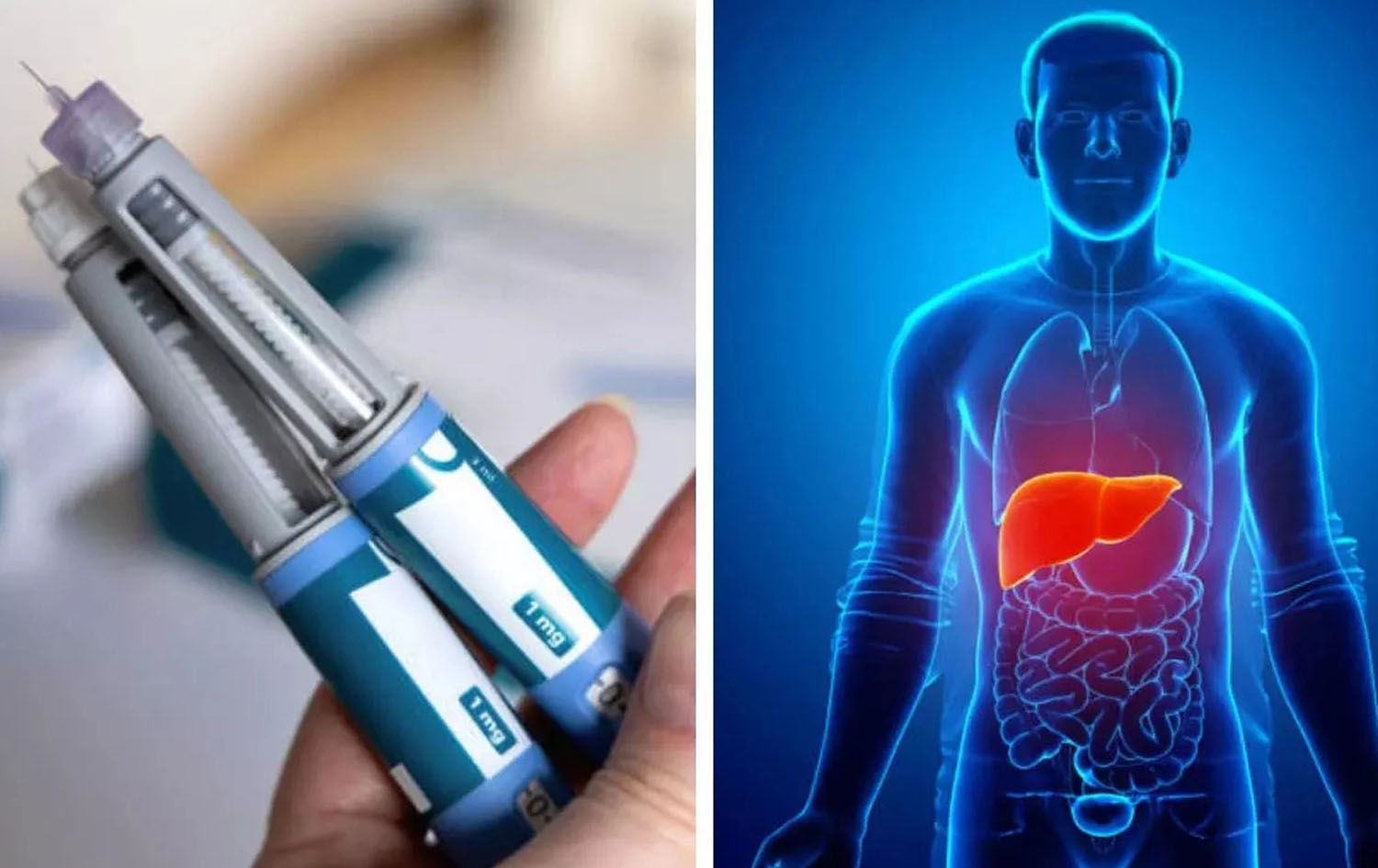 توێژینەوەیەک: دەرمانی کێشدابەزاندن ئەگەری تووشبوون بە نەخۆشییەکانی جگەر کەمدەکاتەوە