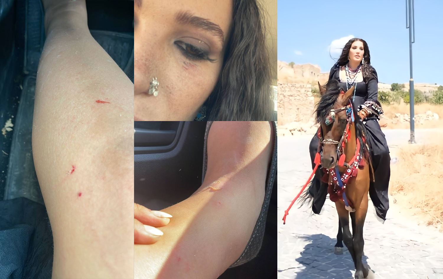 گۆنول دیلان لەسەر ئەسپ خۆی هەڵدەداتە خوارەوە و بریندار دەبێت