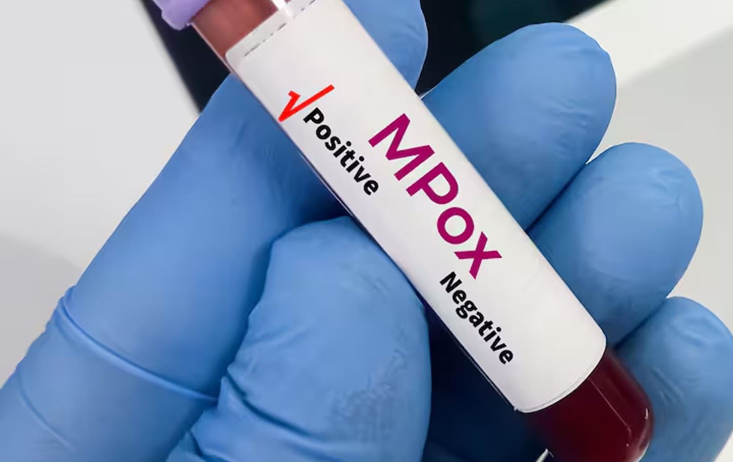 WHO: نزیکەی 30 هەزار تووشبووی 'ئاوڵەی مەیموون' لە ئەفریقا تۆمارکراون