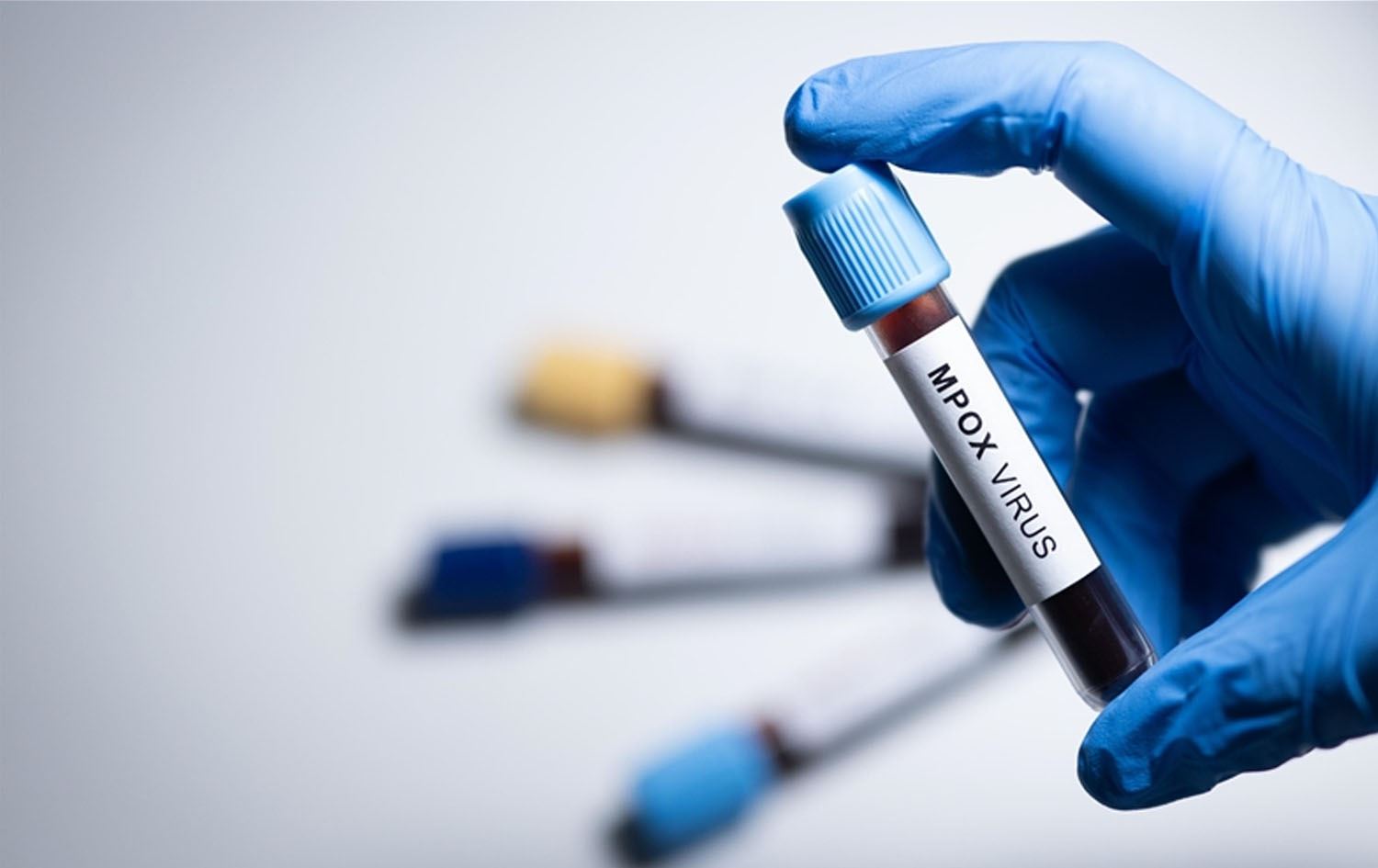 لە هیندستان تووشبووێکی دیکەی نەخۆشیی 'ئاوڵەی مەیموون' تۆمارکرا