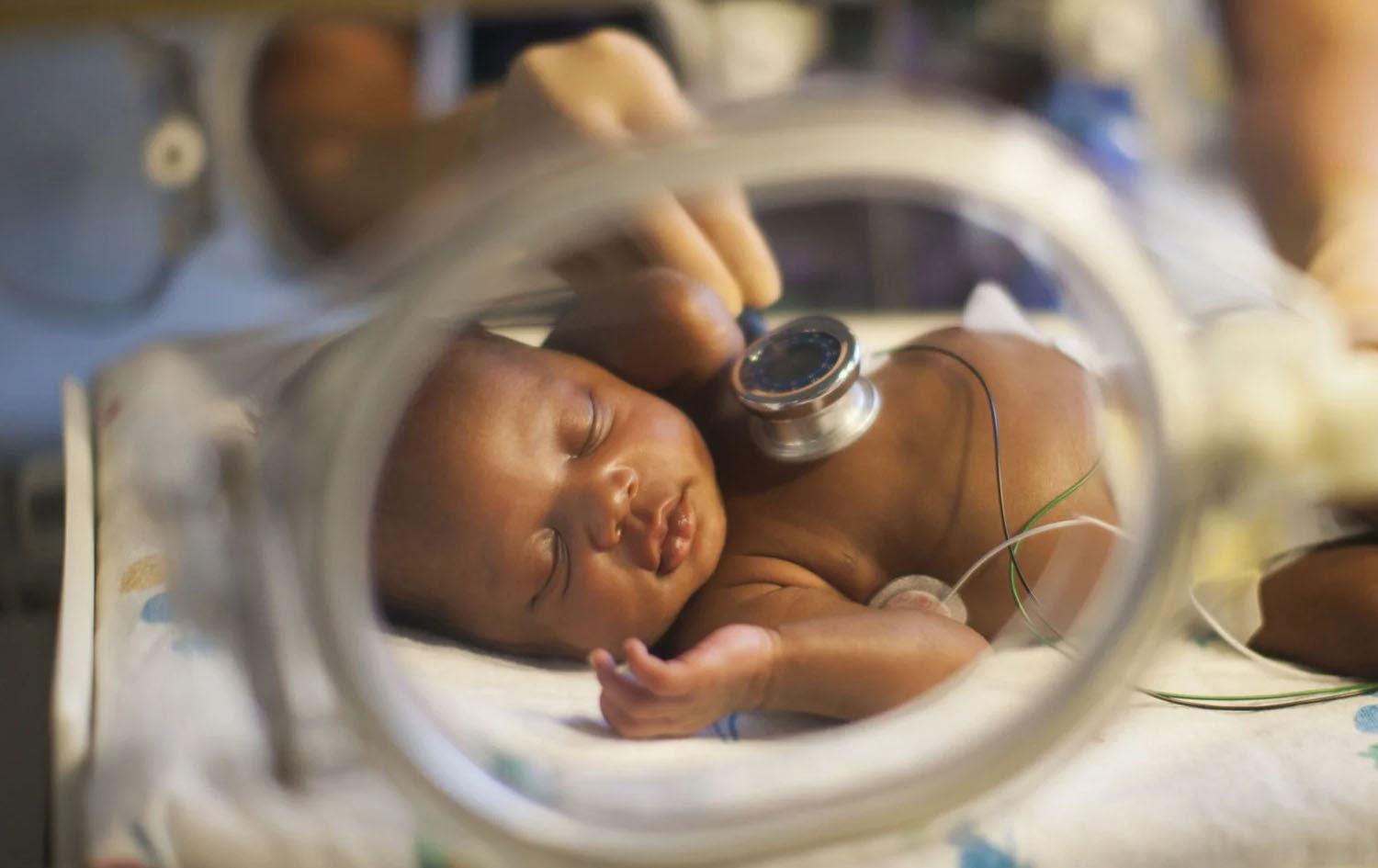 زانکۆی مایەر لە نیویۆرک: لەدایکبوونی پێشوەختە لە ئەمریکا لە زیادبوونە