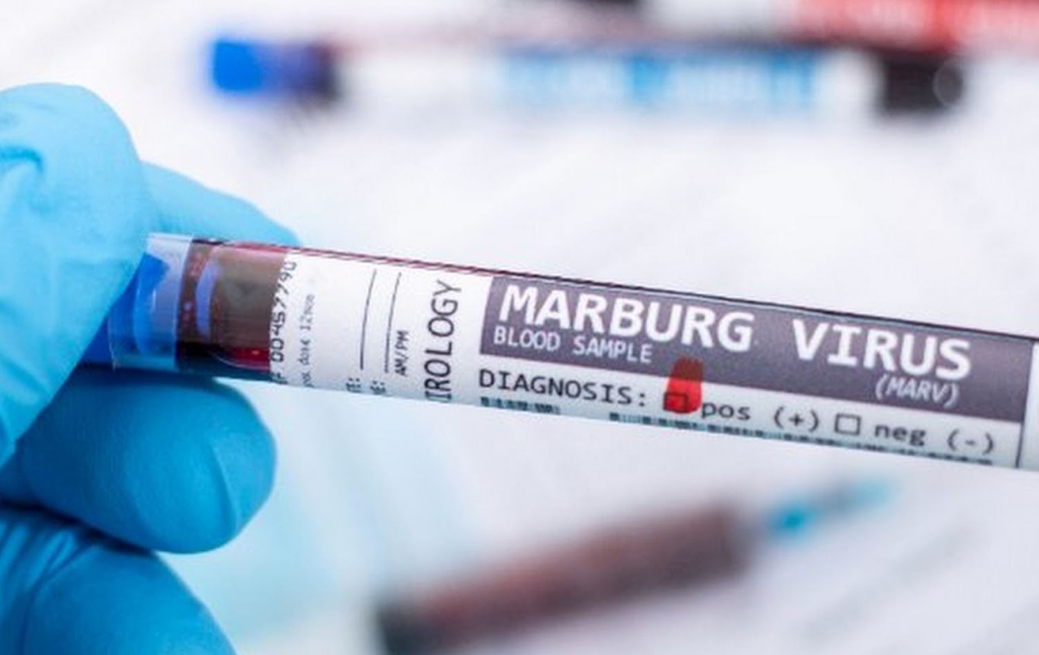 لە رواندا ڤایرۆسێکی دیکەی کووشندە بڵاودەبێتەوە