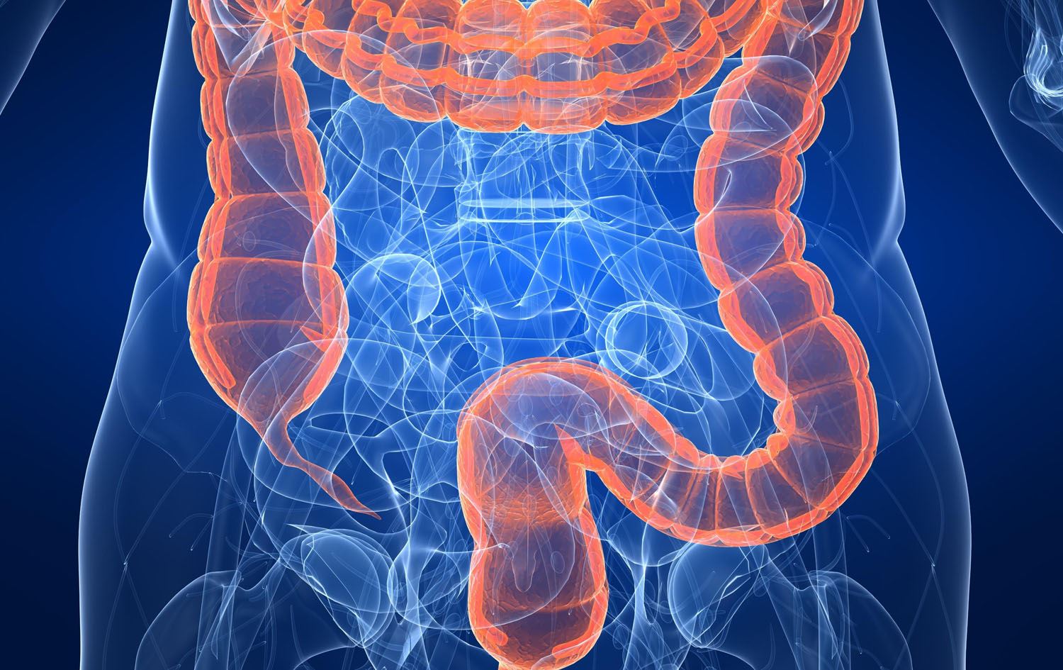 توێژینەوەیەک: گوشاری دەروونی و نەخەوتن ئەگەری تووشبوون بە شێرپەنجەی کۆڵۆن و ریخۆڵە زیاددەکەن