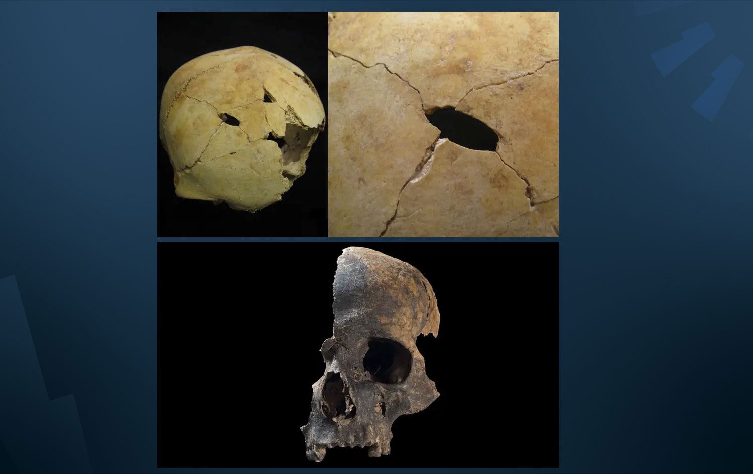 Öldürülen kişilere ait kemiklerde çok sayıda ize rastlandı