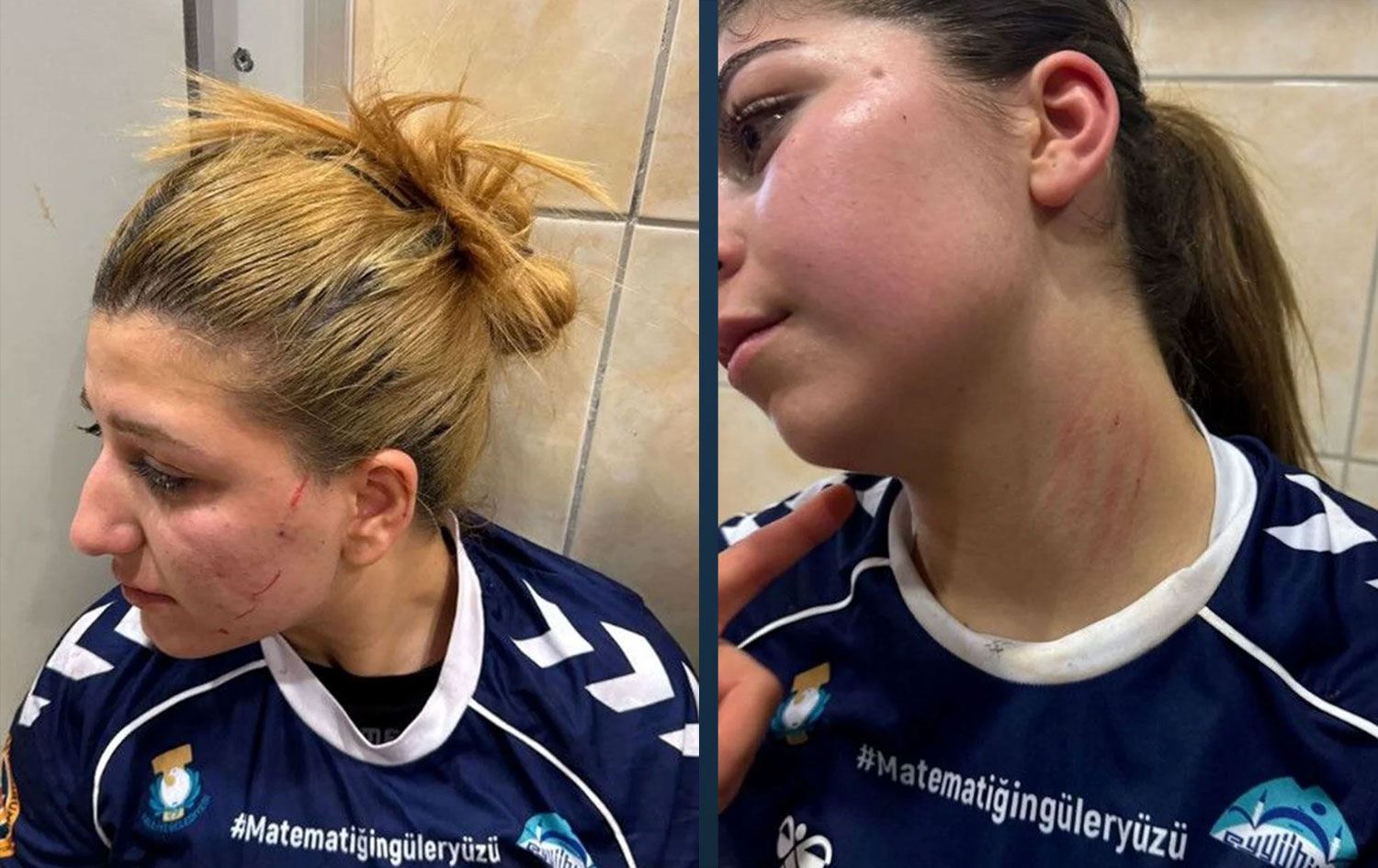 Saldırıya uğrayan kadın sporcular 