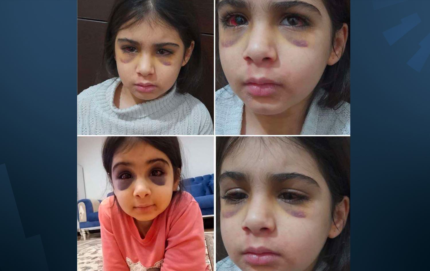 Anîla Seîdî /Wêne: Torên civakî