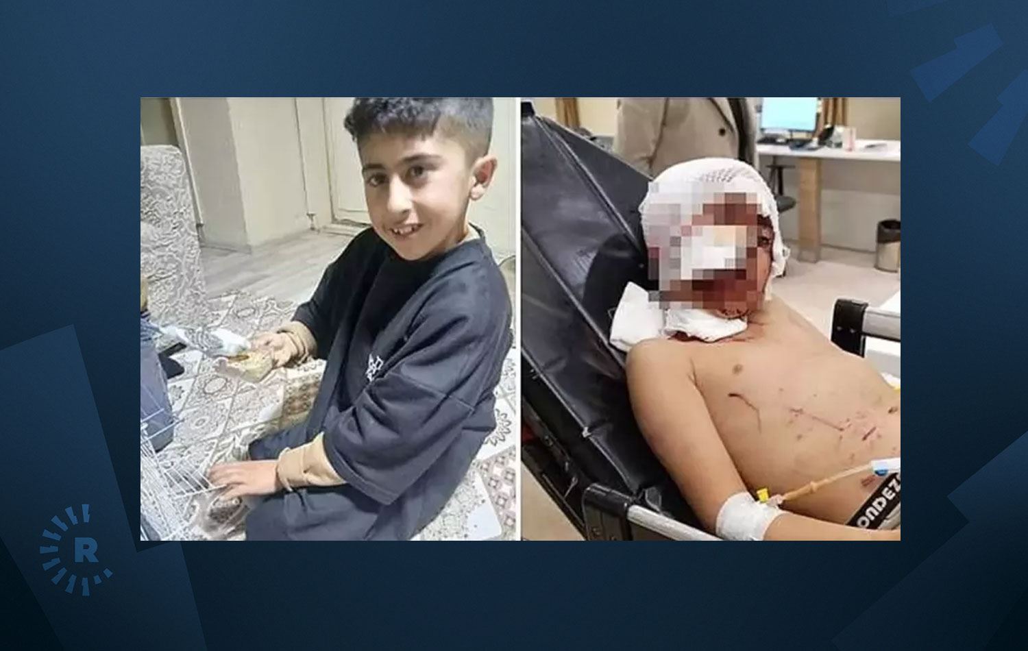 11 yaşındaki çocuk ağır yaralandı. / Foto: DHA