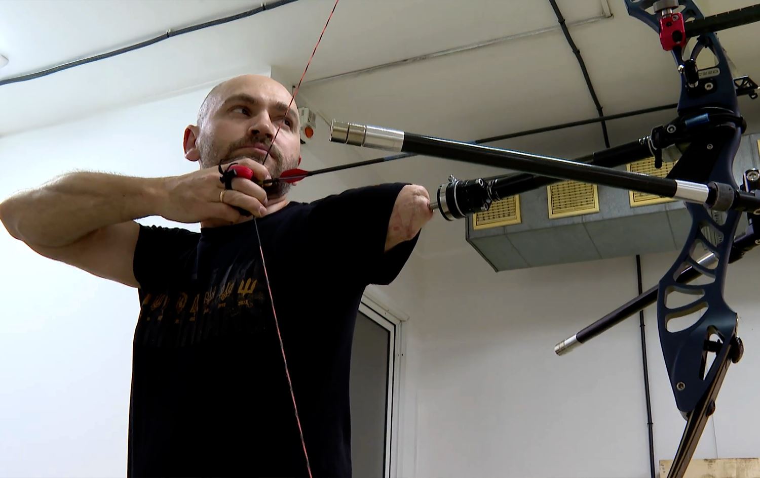 More than 50,000 Ukrainians have lost limbs in conflict with Russia