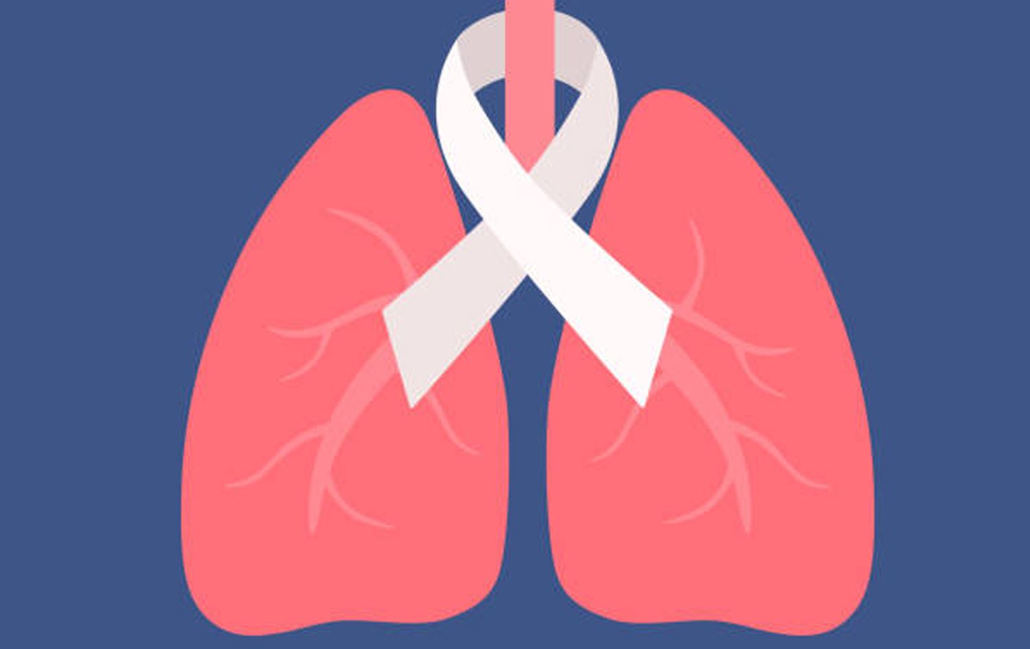 عێراق هەڵمەتی دەستنیشانکردنی پێشوەختەی شێرپەنجەی سییەکان و پرۆستات رادەگەیێنێت