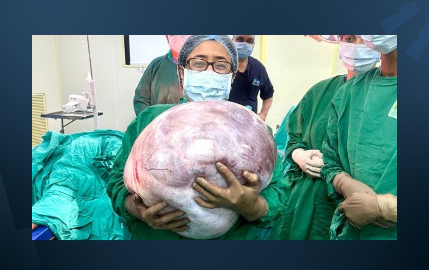 گرێیەکی 18 کیلۆگرامی لە هێلکەدانی خانمێک دەردەهێنرێت