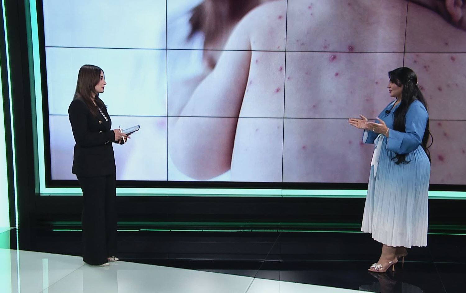 پسپۆڕێک: منداڵ بە ڤاکسینی دژەسوورێژە نەکوترێت، ژیانی دەکەوێتە مەترسییەوە