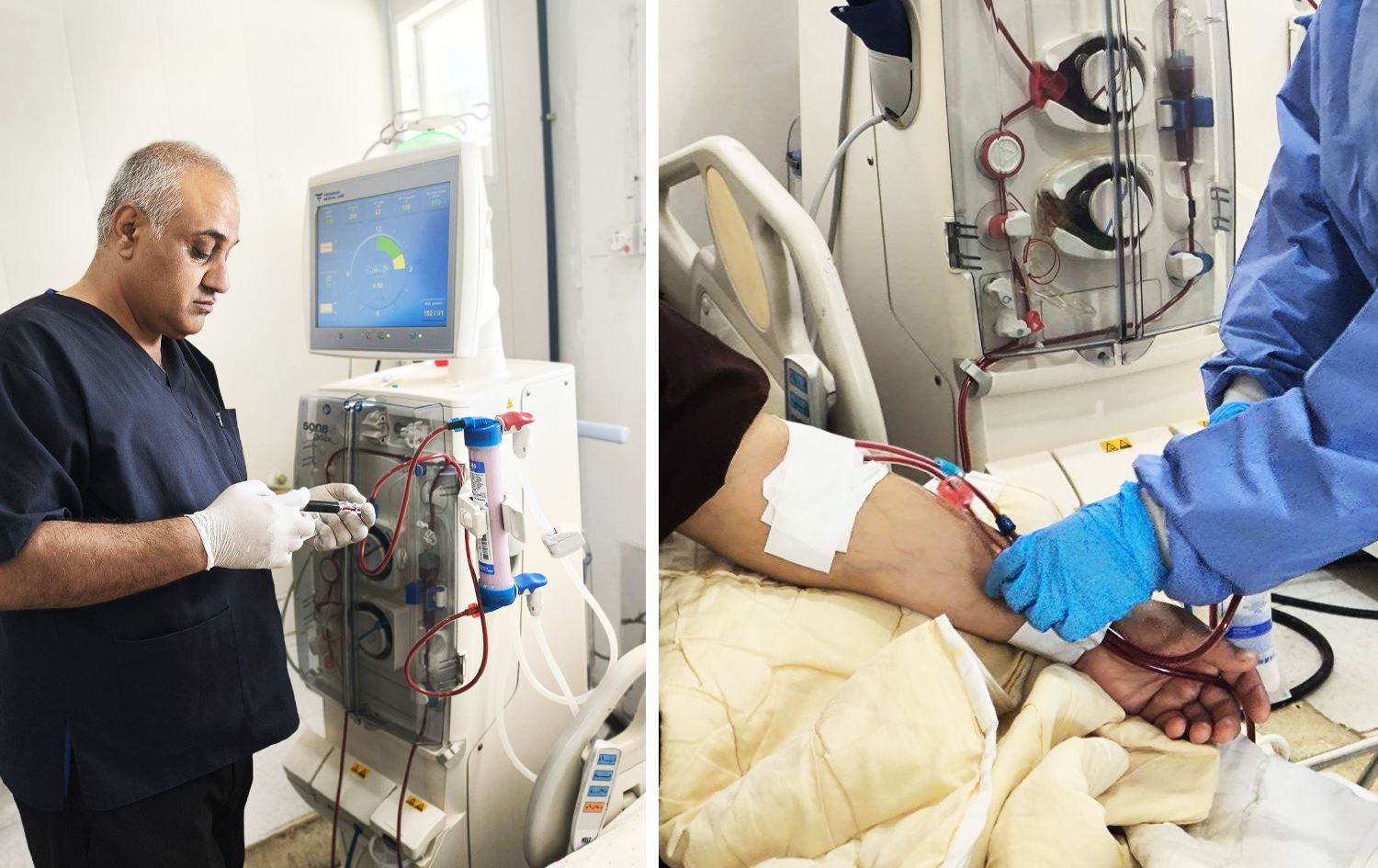 تەندروستیی کۆیە: نزیکین لە چارەسەرکردنی کێشەی سەنتەرێکی تەواونەکراوی شووشتنی گورچیلە