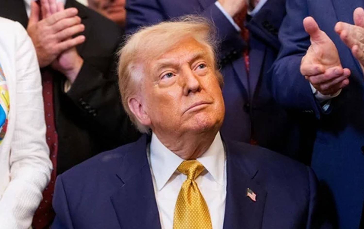 ترەمپ تووشی نەخۆشییەک بووە، قاچەکانی خوێنیان بۆ ناچێت و ئەستوور دەبن