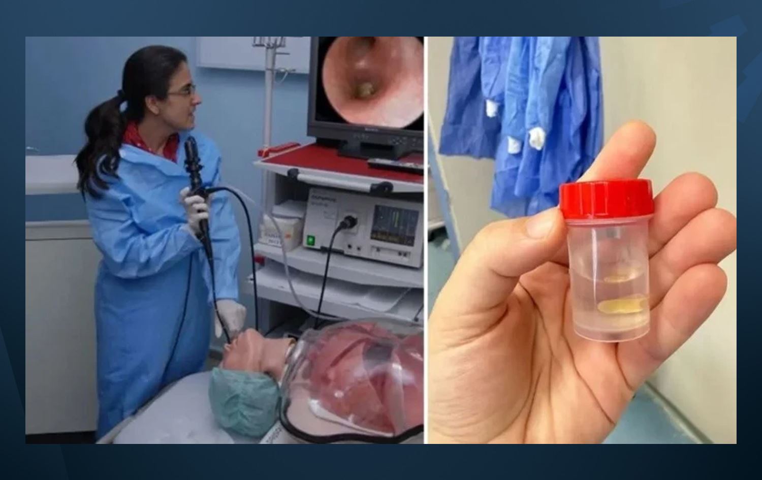 ژنێکی بەساڵاچوو لە تورکیا بەهۆی دەنکە گەنمەشامییەکەوە خەریک بووە گیان لەدەستبدات