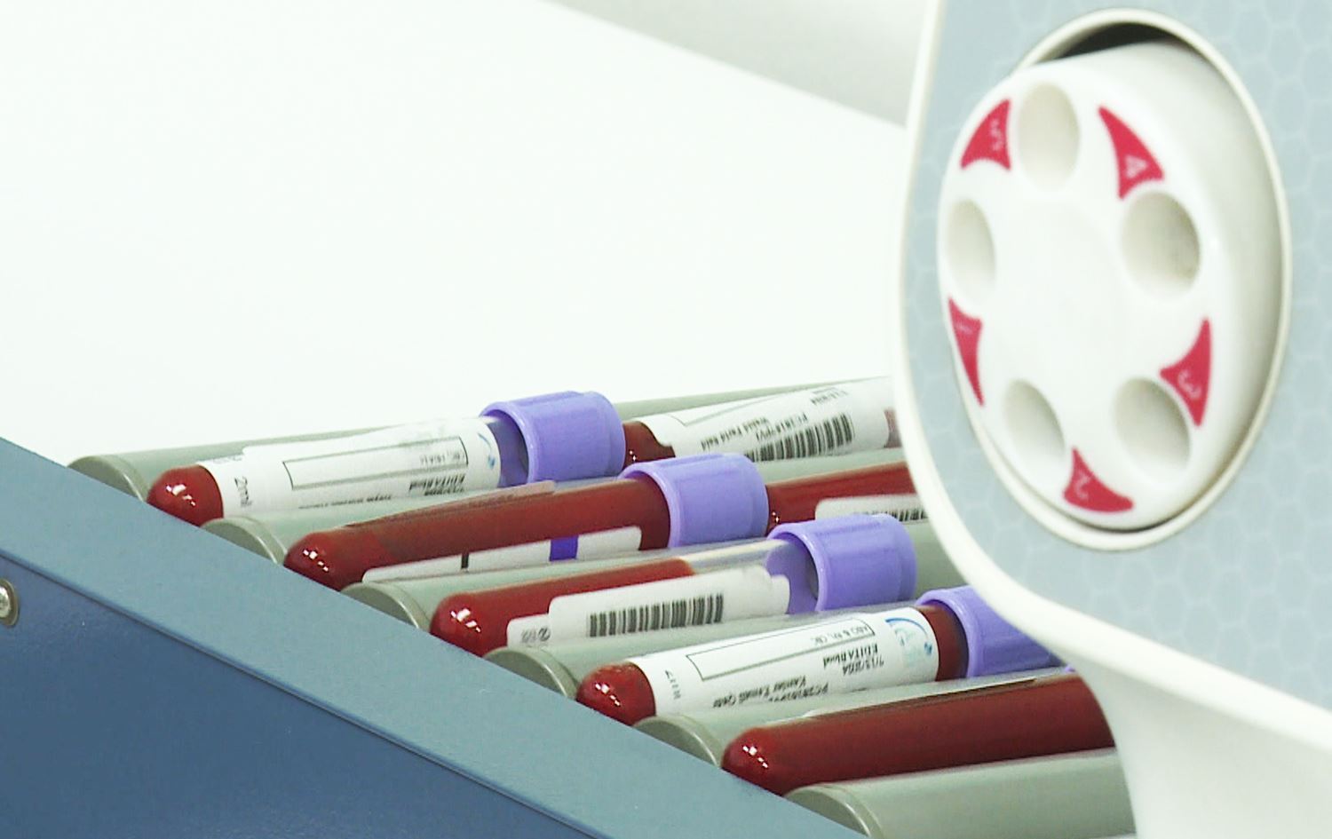 تەندروستیی هەولێر: لەمەودوا پشکنینە تاقیگەییەکانی دڵنیابوونەوە لێرە دەکرێن و ناچنە بەغدا