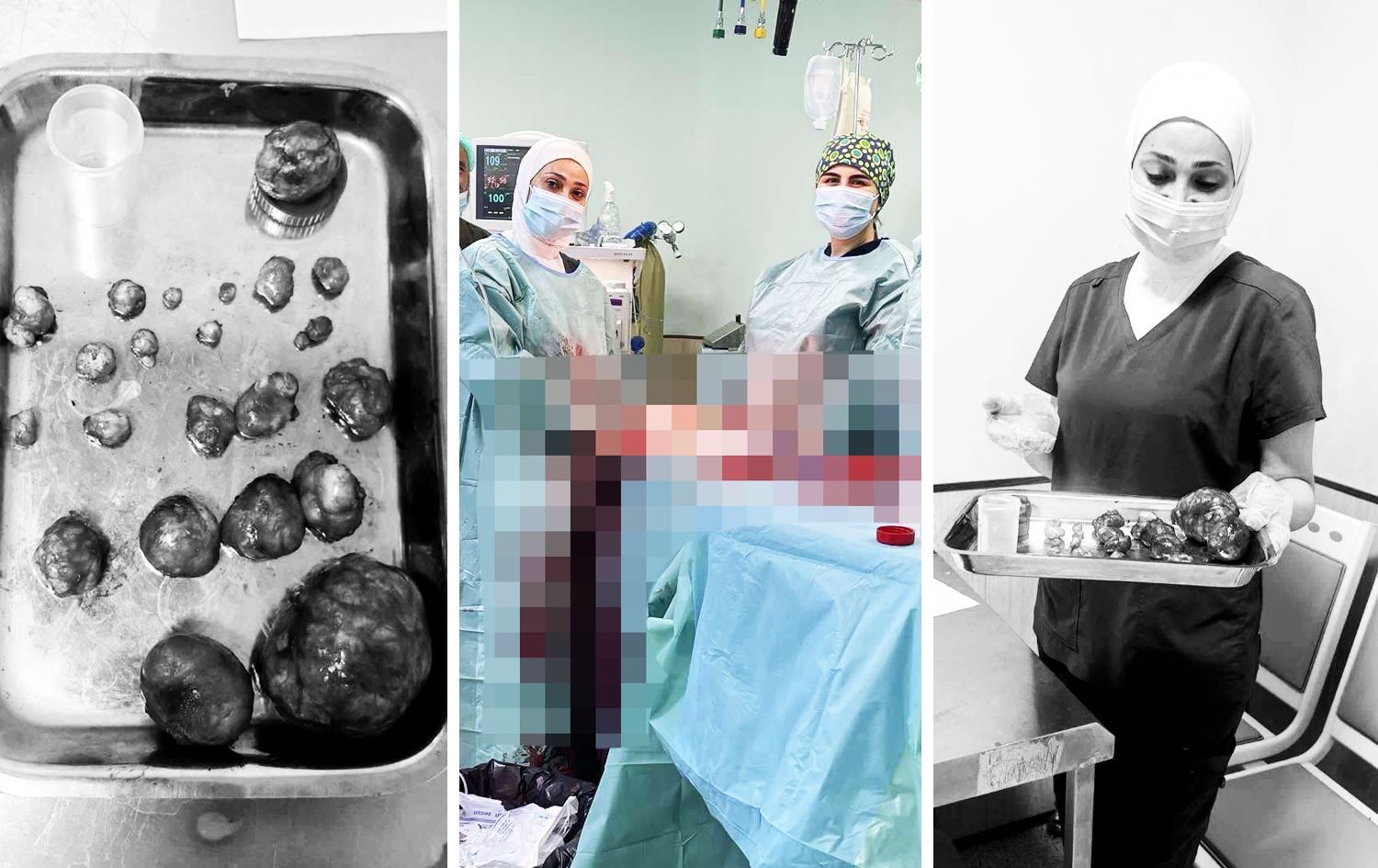 Dr. Zeyneb Ebas girêk danîne ser amûreke tenduristiyê / Wêne: Ji Rûdawê re hat şandin