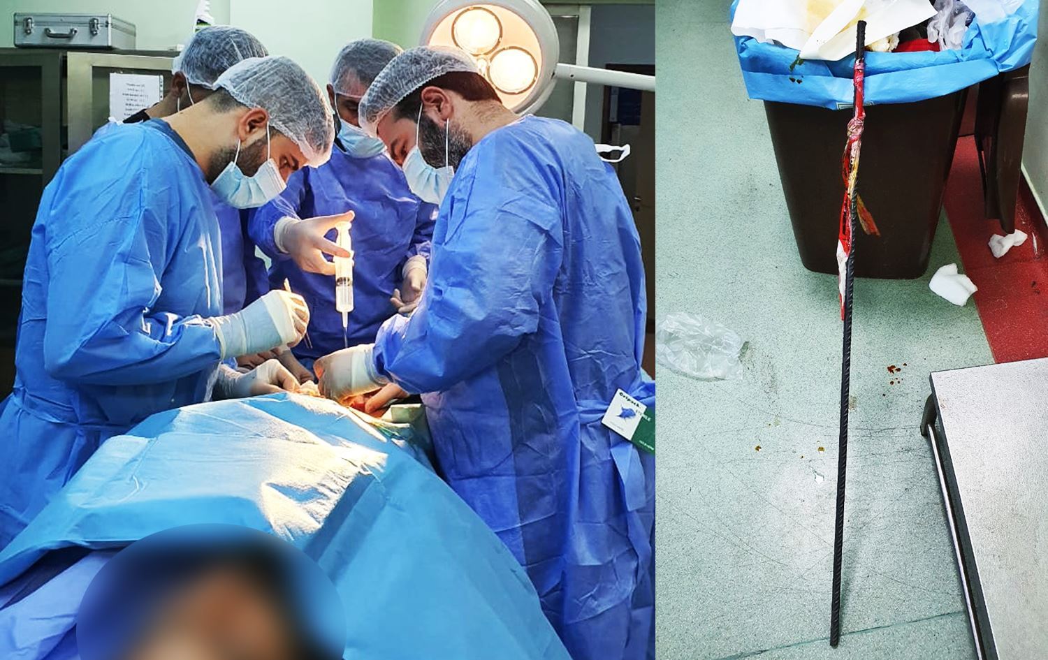 40 santimetrelik demir şiş inşaat işçisinin testisine saplandı  