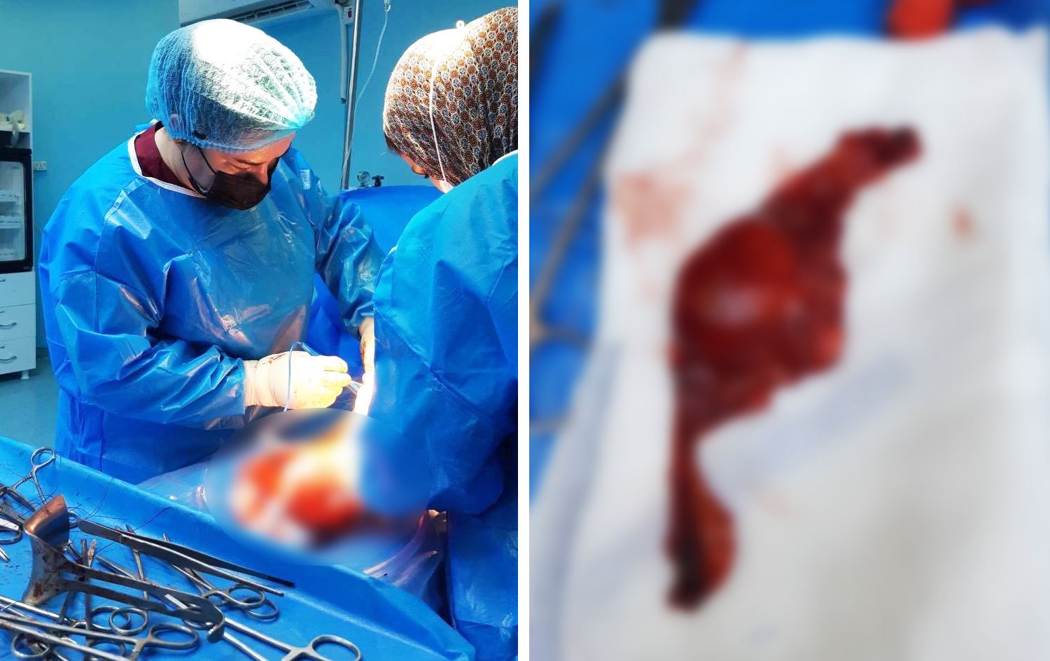 لە سۆران خانمێک زێی دادەخزێت و بەهۆی هەڵەیەکییەوە، منداڵدانی لەدەستدەدات