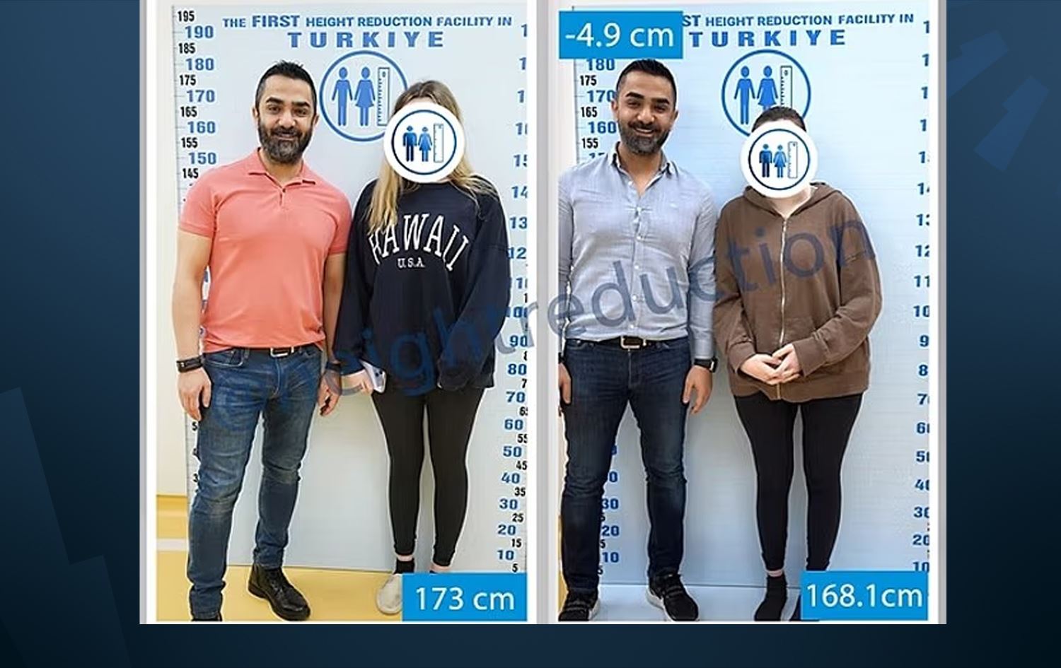 تورکیا بووەتە شوێنی نەشتەرگەرییەکی دەگمەن؛ ژنان باڵایان کورت دەکەنەوە