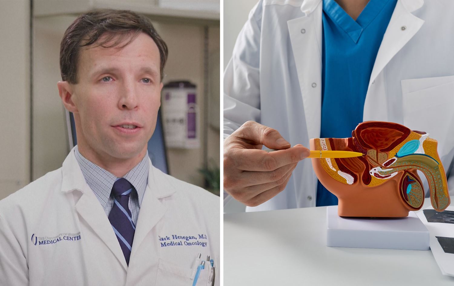 پڕۆفیسۆرێک لەبارەی شێرپەنجەی پڕۆستاتەوە: دووەم هۆکاری مردنی پیاوانە