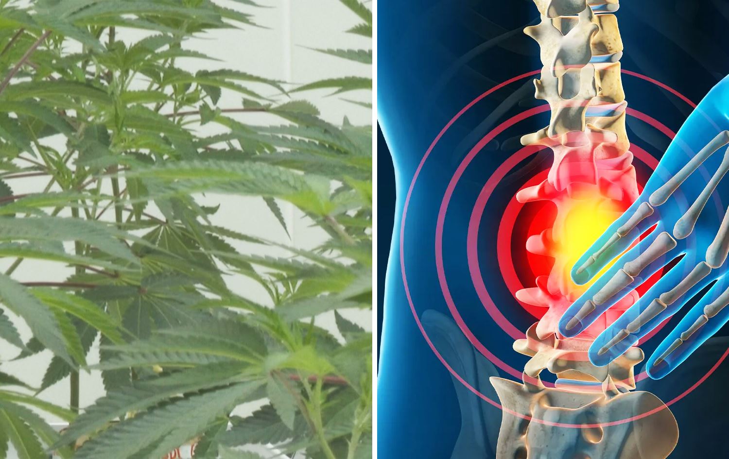 لە ئەڵمانیا 800 کەس بە ماریوانا لە پشتئێشەی درێژخایەن چاکبوونەتەوە