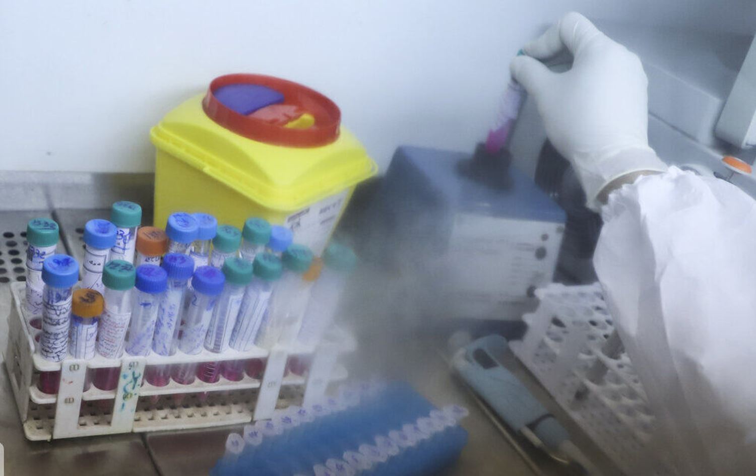 تەندروستیی سنە: 25 تووشبووی نوێی سیل تۆمارکراون