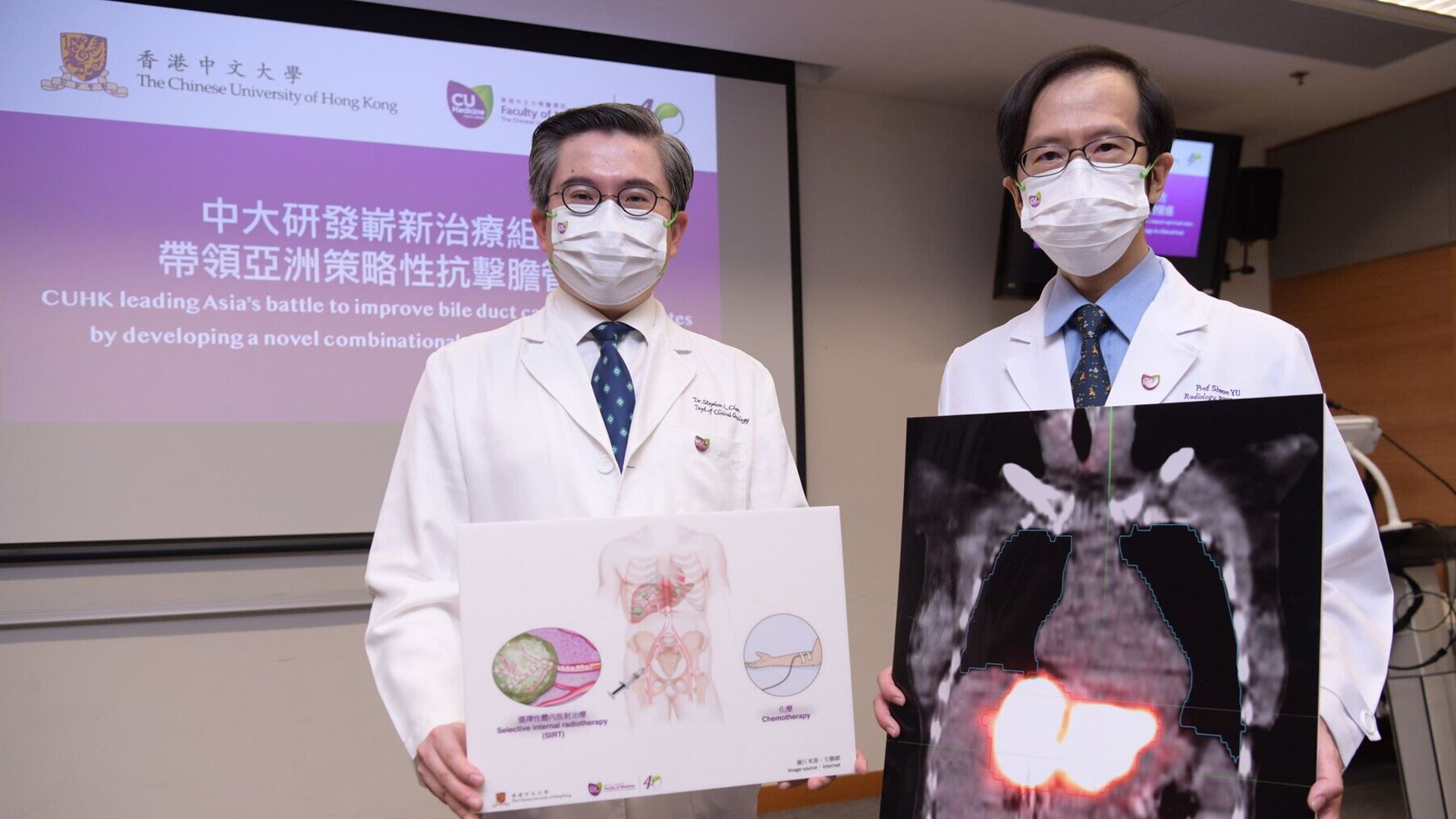 لە چین رێگەیەکی 'نوێ و کاریگەر' بۆ چارەسەری شێرپەنجەی بۆڕیی زراو پێشنیاز دەکرێت