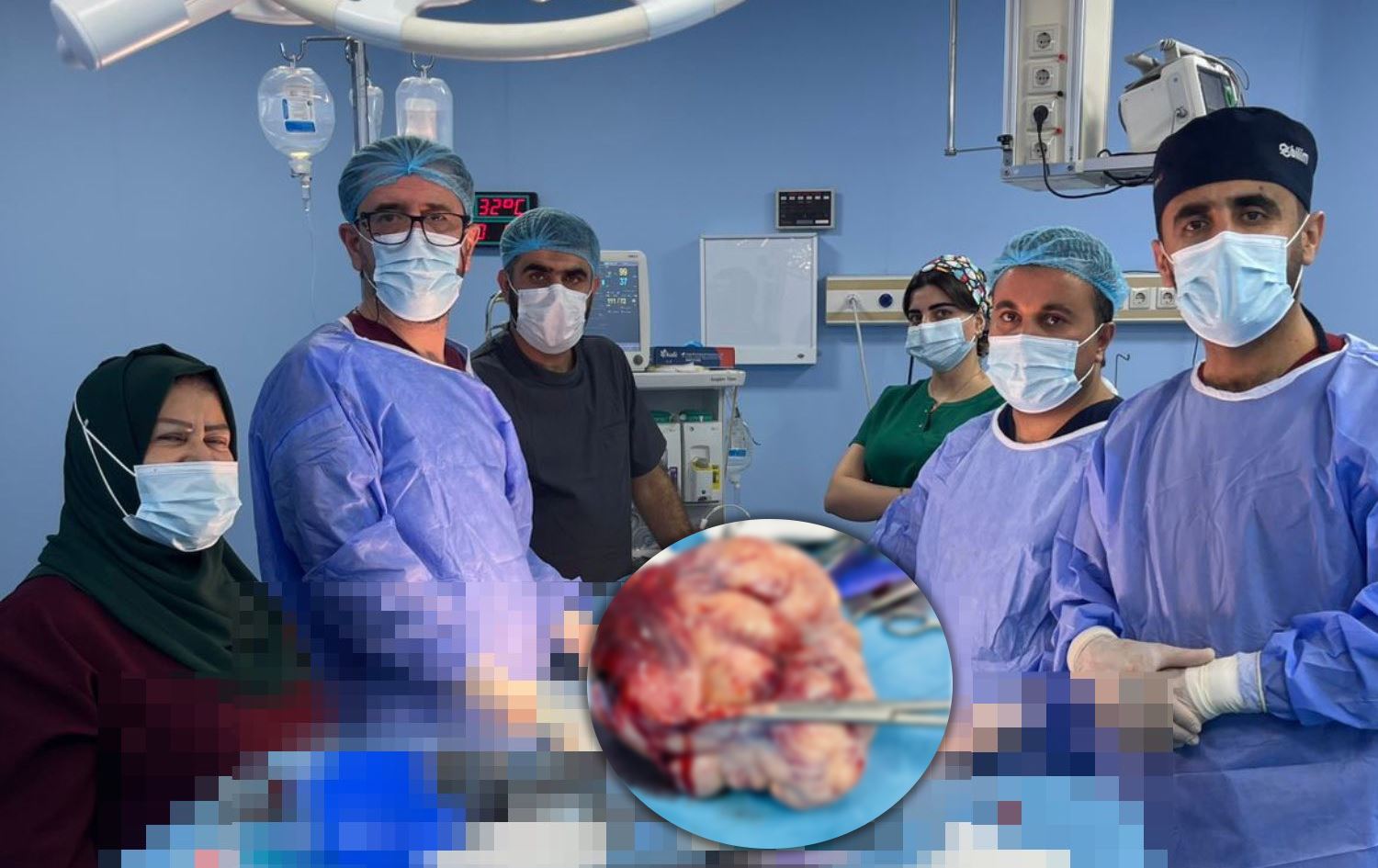 لە ئاکرێ گرێیەکی کیلۆ و نیوی لە هێلکەدانی کچێکی نەوجەواندا دەردەهێنرێت