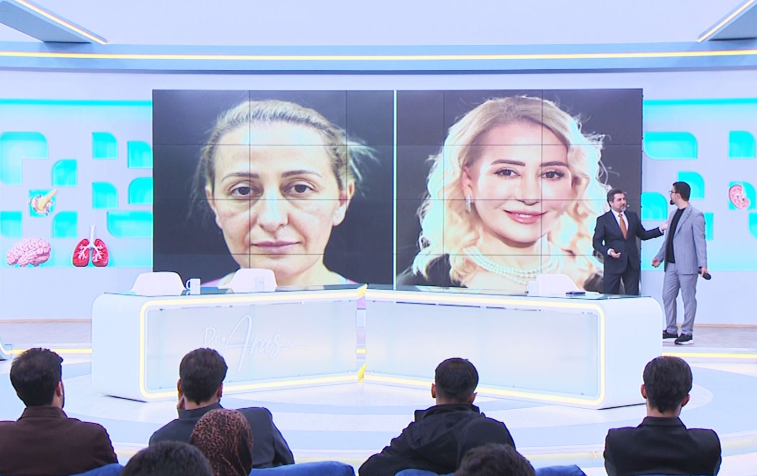 خانمێک 16 ساڵ گەنج بووەتەوە و لە بەرنامەی دکتۆر ئاراس باسی دەکرێت