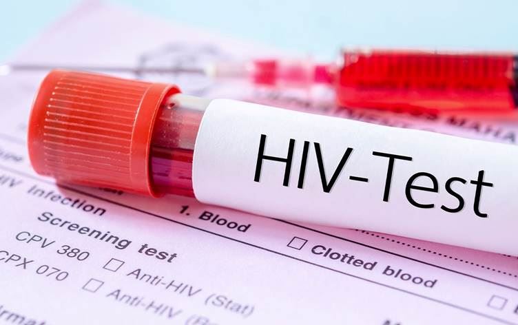 Testeke AIDSê /Wêne: Arşîv