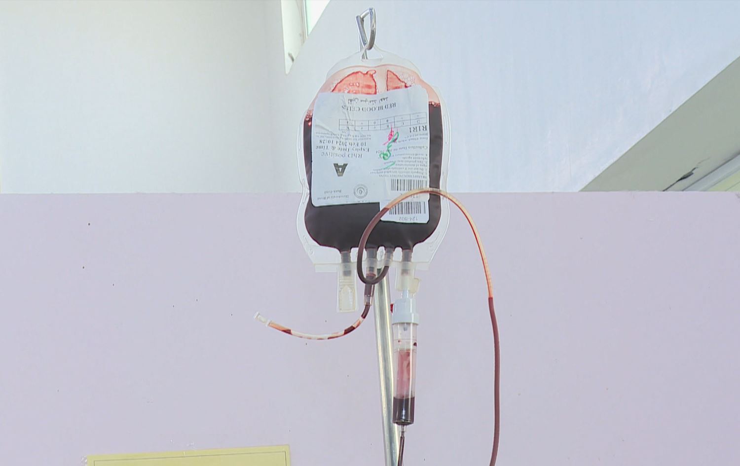 کیسێکی خوێن کە بۆ تووشبووانی تالاسیمیا دادەنرێت بۆ ئەوەی خوێن وەربگرن. 