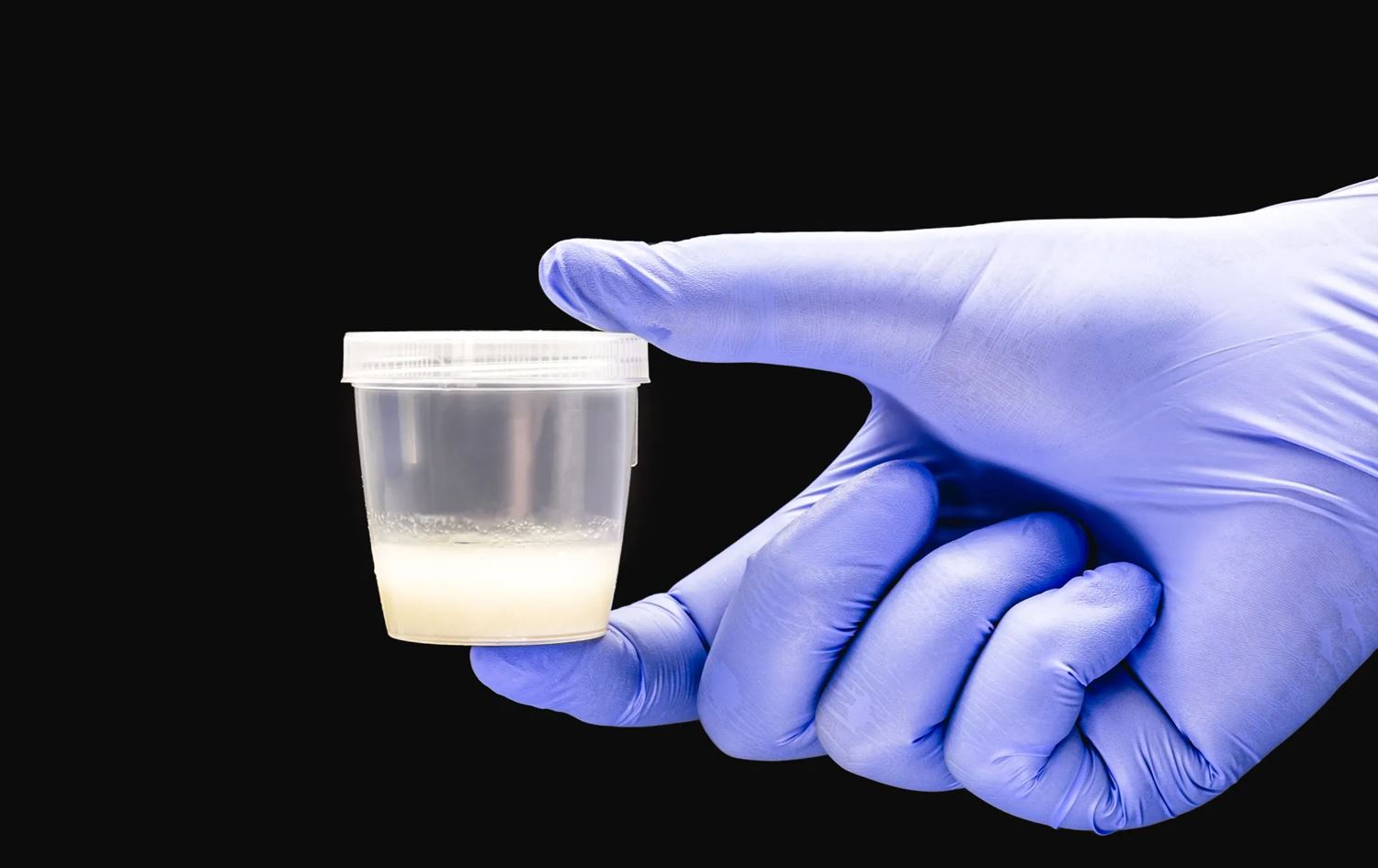 کەمۆڵەیەک کە سپێرمی تێدایە.