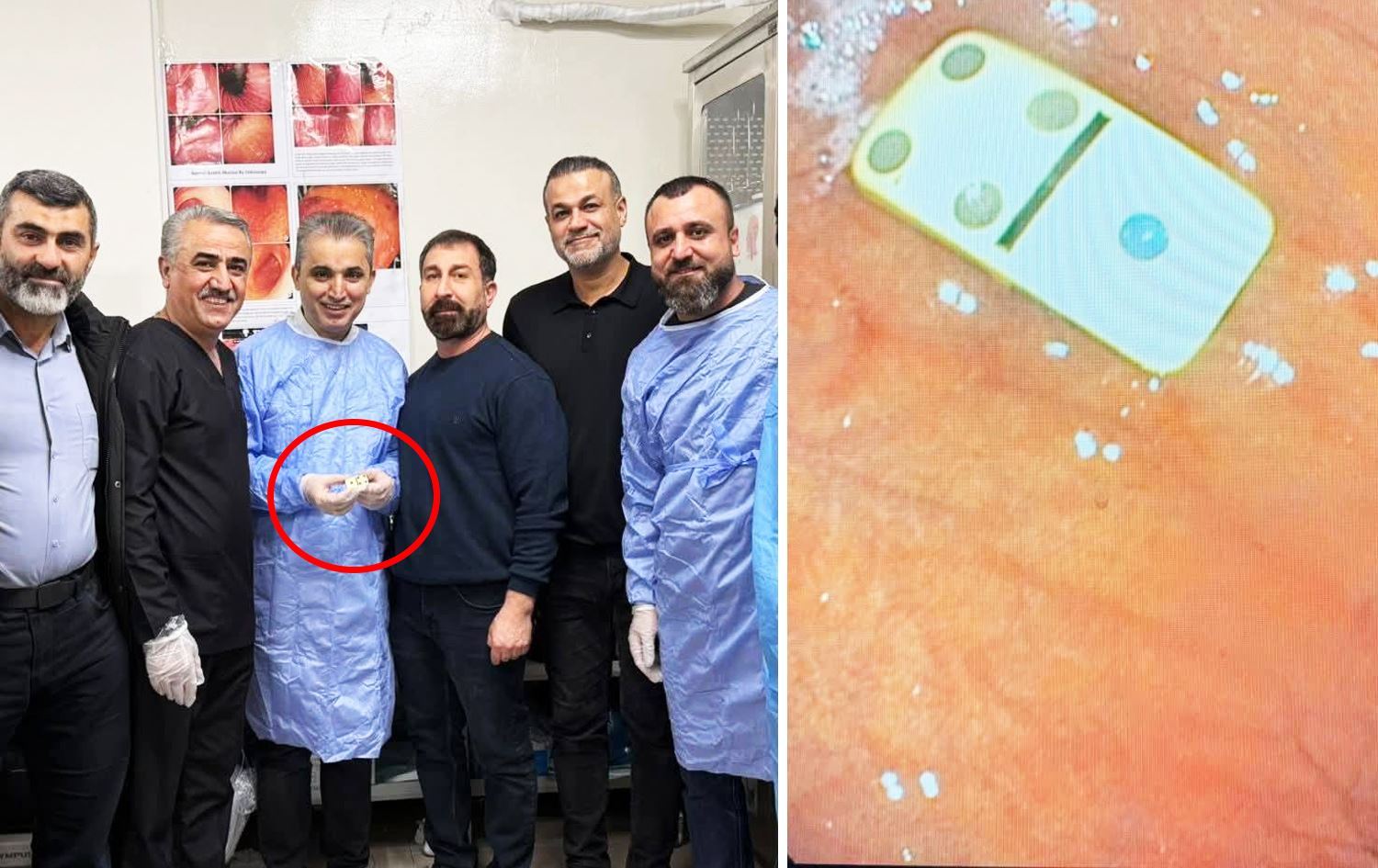 صورة لقطعة الدومينو والطبيب رفقة ذووي الفتى