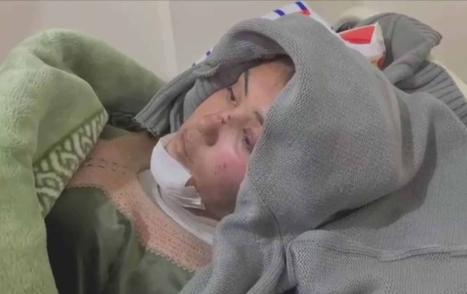 امرأة كوردية من ريف كوباني تعرضت مع عائلتها للقصف