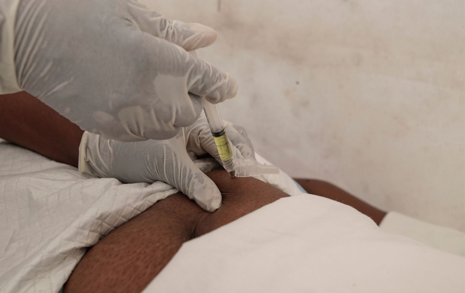 حق أحد الأشخاص بلقاح ضد الإيدز - AP