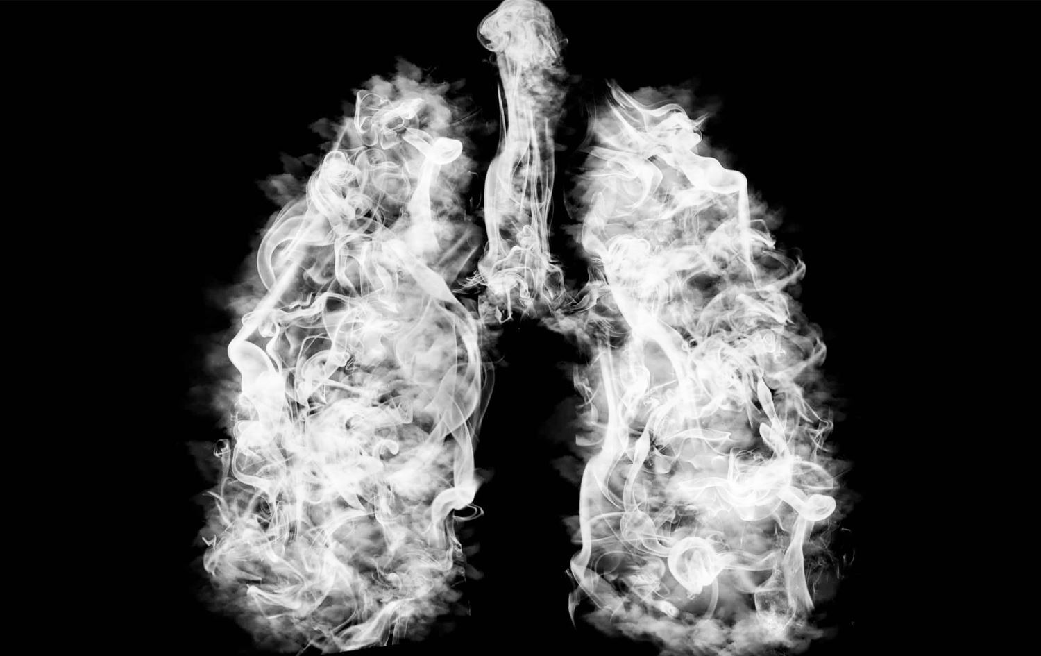 وێنەی سییەکان کە بە دووکەڵ داپۆشراوە.