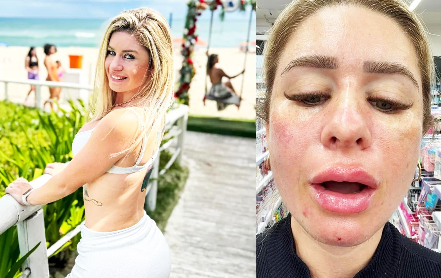 دێبۆرا پێکشۆتۆ دوای فیلەرەکانی و وێنەیەکی ئاسایی خۆی.