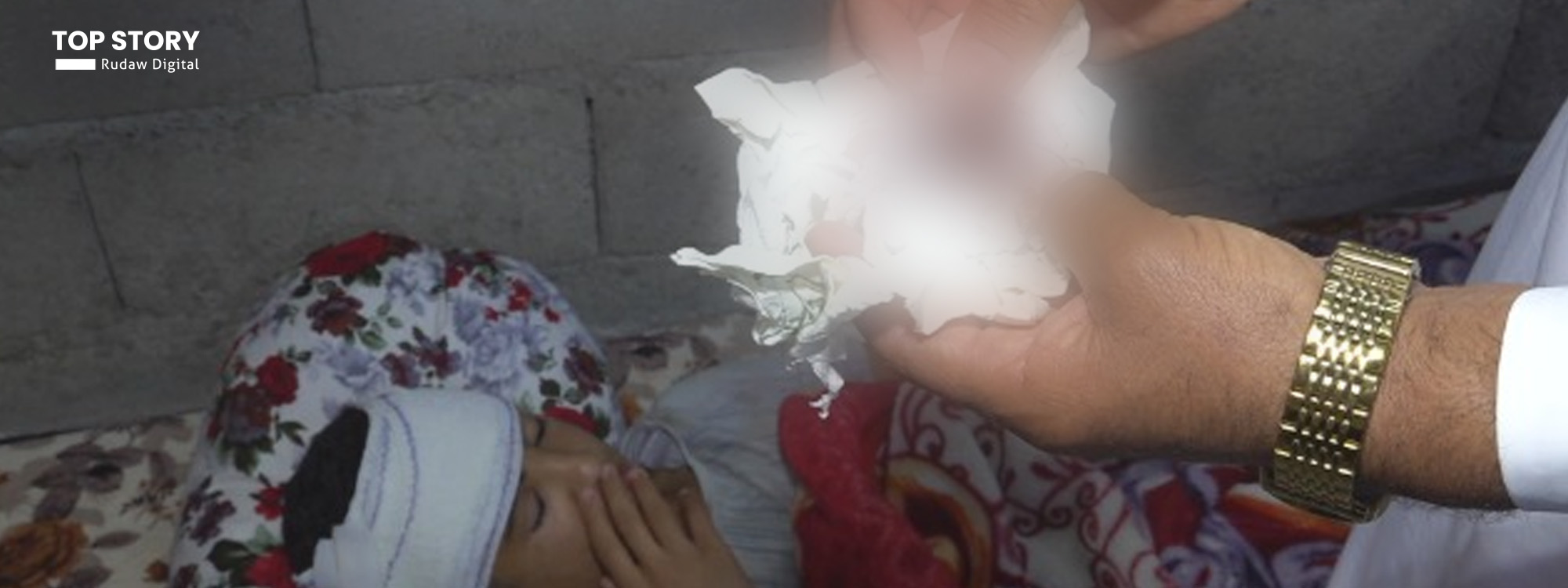 اثار اصابة الطالب أوس