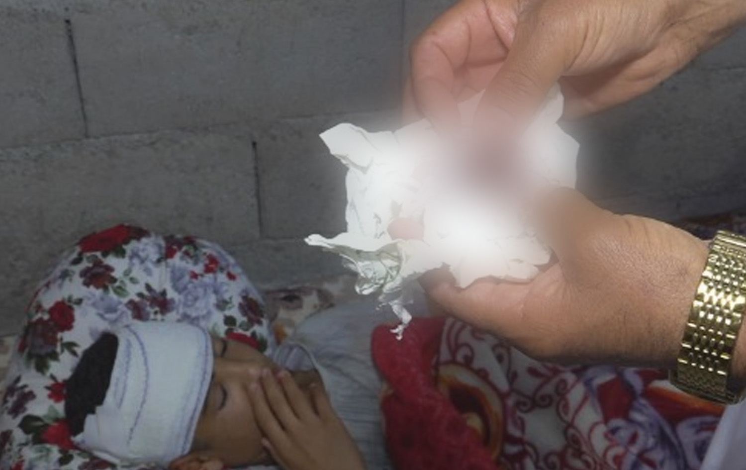 اثار اصابة الطالب أوس